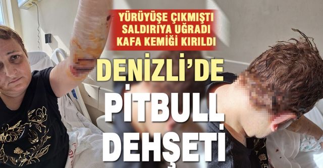 Acıpayam’da Pitbull Dehşeti! Kafatası Kırılan Kadın Ölümden Döndü Acıpayam’da Pitbull Dehşeti! Kafatası Kırılan Kadın Ölümden Döndü